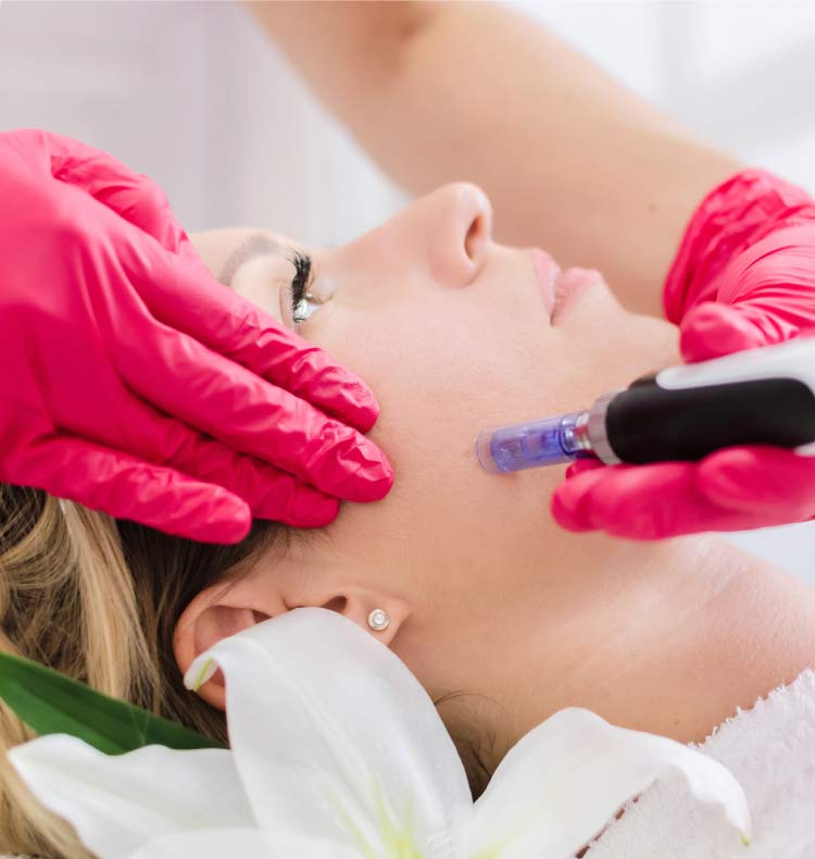 Microneedling